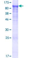 Human KBTBD6 Protein (Recombinant GST)