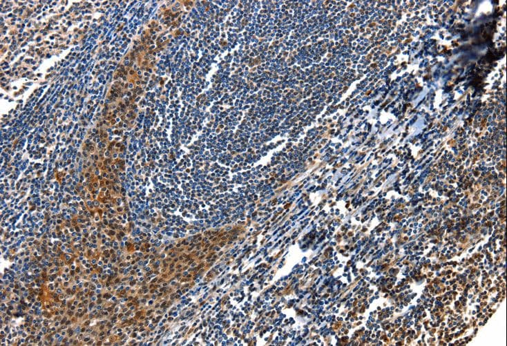Polyclonal Rabbit anti-Human AQP2 / Aquaporin 2 Antibody (IHC)