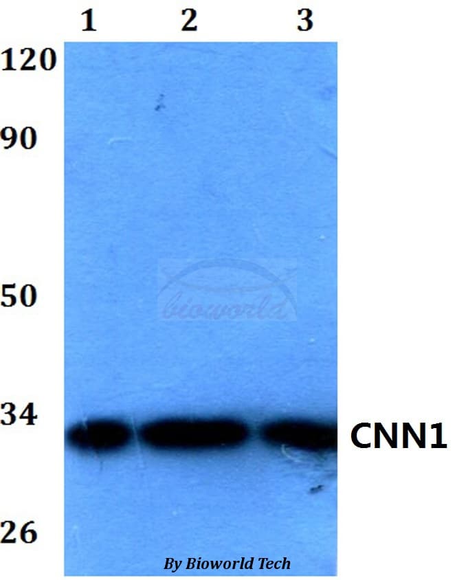 Polyclonal Rabbit anti-Human CNN1 / Calponin Antibody (WB)