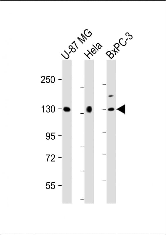 MGEA5 Antibody (N-Terminus)
