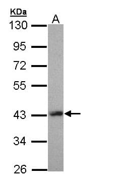 IHC-plus™ LHX8 Antibody