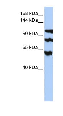 PPP1R13B Antibody (aa900-949)