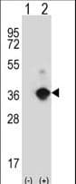 ANGPTL7 / CDT6 Antibody (aa74-104)