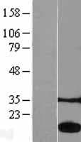 ACP1 / Acid Phosphatase Protein (Over-Expression Lysate Myc-DDK (Flag))