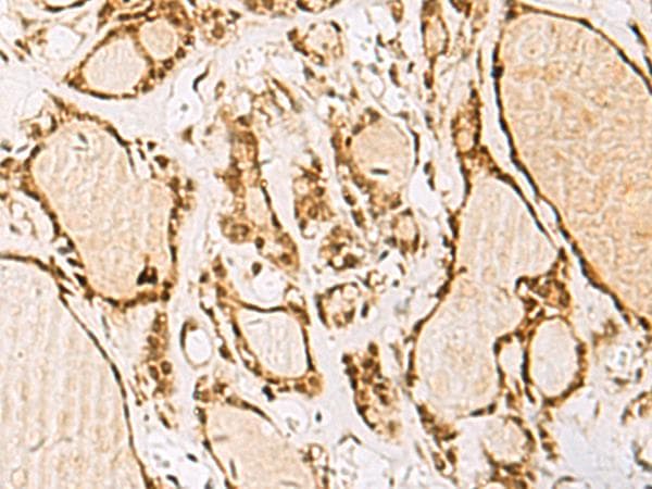 IDN3 / NIPBL Antibody