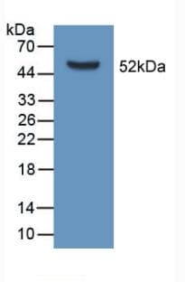 APOD / Apolipoprotein D Antibody (aa1-189)