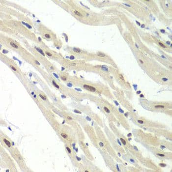 RENT1 / UPF1 Antibody