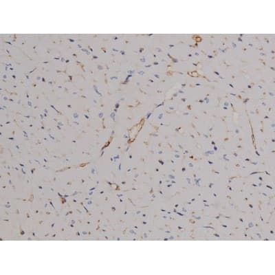 STAT6 Antibody (phospho-Tyr641)