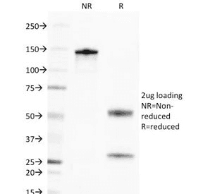 Monoclonal Mouse anti-Human Golgi Body Antibody (clone 371-4, IHC, IF, WB)