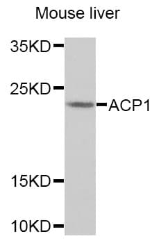 ACP1 / Acid Phosphatase Antibody