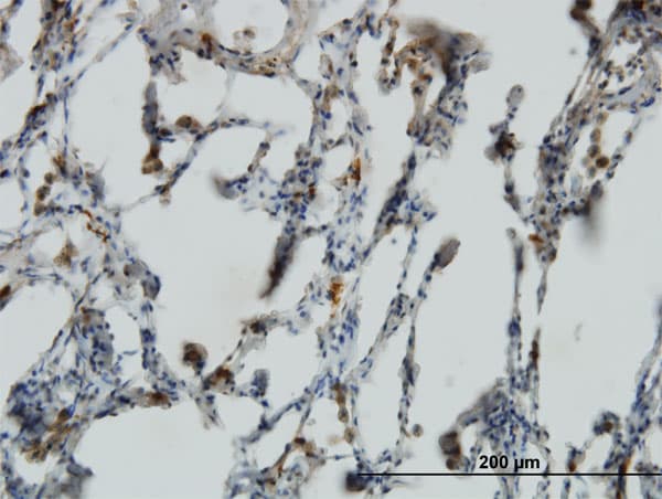PRELID1 Antibody (clone 7B4)