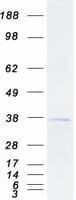 Human SPRY2 / Sprouty 2 Protein (Recombinant Myc-DDK (Flag))