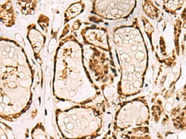 LRRC2 Antibody