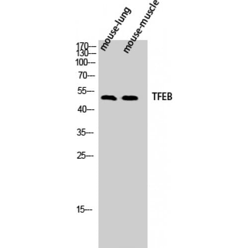 TFEB Antibody (10-90 aa, N-terminal)