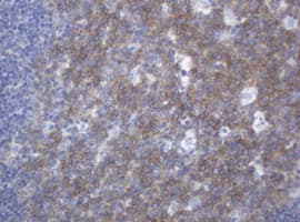 MUC16 / CA125 Antibody (clone OTI2C4)