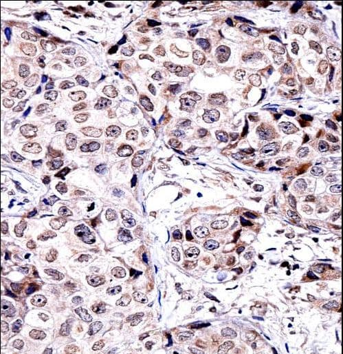 SIRT6 / Sirtuin 6 Antibody (aa276-305)
