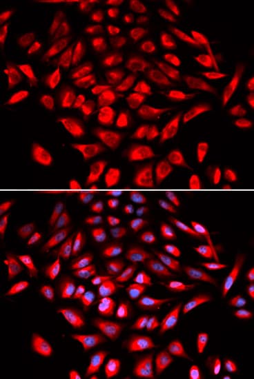Polyclonal Rabbit anti-Human CAMK4 / CaMK IV Antibody (IHC, IF, WB)