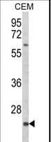 IHC-plus™ KLRC2 / NKG2C / CD159c Antibody (aa1-30)
