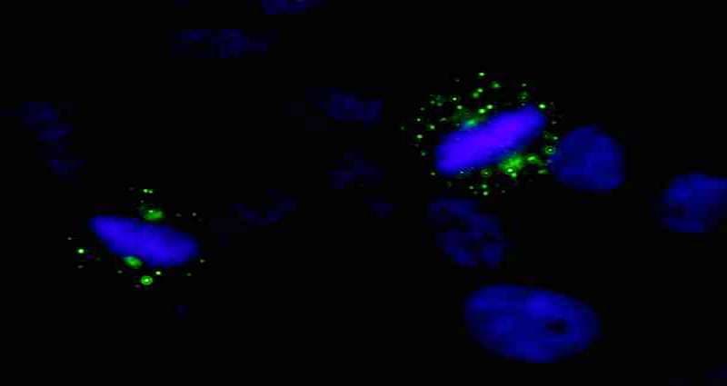 AURKA / Aurora-A Antibody (aa75-125)