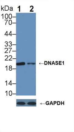 Polyclonal Rabbit anti-Human DNASE1 / DNase I Antibody (aa19-259, WB)
