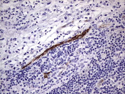 VWF / Von Willebrand Factor Antibody (aa764-1263, clone OTI7G3, Carrier-free)