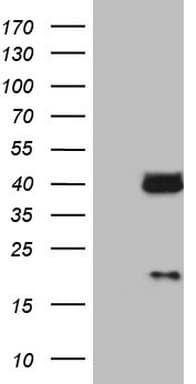 LGALS9 / Galectin 9 Antibody (clone OTI19F7)