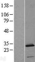 C2orf88 Protein (Over-Expression Lysate Myc-DDK (Flag))
