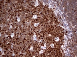 Monoclonal Mouse anti-Human TOP2A / Topoisomerase II Alpha Antibody (clone OTI2D12, aa1100-1531, IHC, WB)