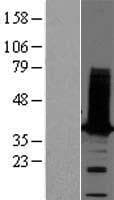 TPM2 Protein (Over-Expression Lysate Myc-DDK (Flag))