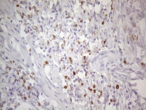 APOBR / APOB48R Antibody (aa780-1088, clone OTI1B5)