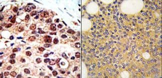 PRMT3 Antibody (aa460-491)