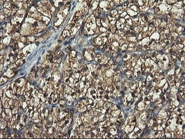 PFKP Antibody (clone OTI2F2, Carrier-free)