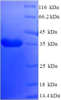 Human DYDC2 Protein (Recombinant His-SUMO)