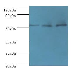 ACVR1C / ALK7 Antibody (aa22-113)