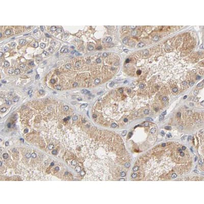 AKT1 Antibody (phospho-Ser473)