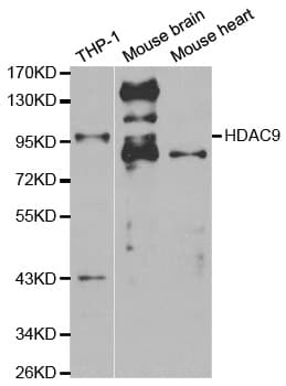 HDAC9 Antibody