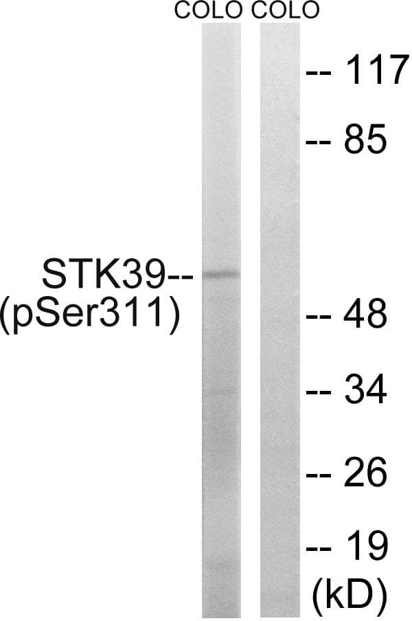 STK39 / SPAK Antibody (phospho-Ser311)