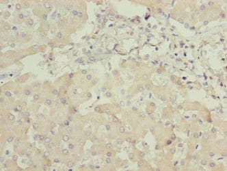 ANKRA2 / ANKRA Antibody