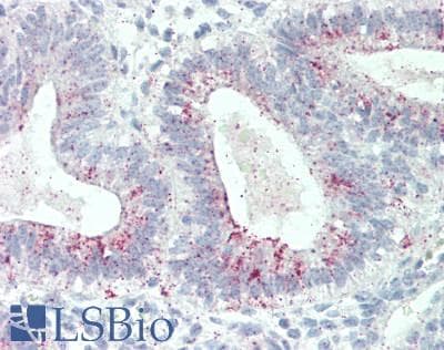 IHC-plus™ Polyclonal Rabbit anti-Human DIXDC1 Antibody (aa225-275, IHC)