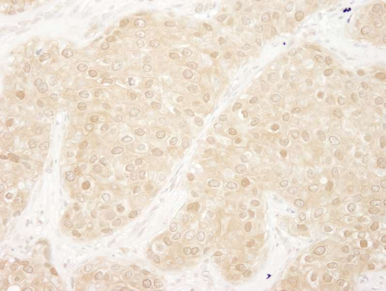 MAPK3 / ERK1 Antibody (aa329-379)