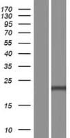 PSMB5 Protein (Over-Expression Lysate Myc-DDK (Flag))