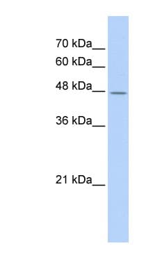 Polyclonal Rabbit anti-Human TAF7L Antibody (C-Terminus, WB)
