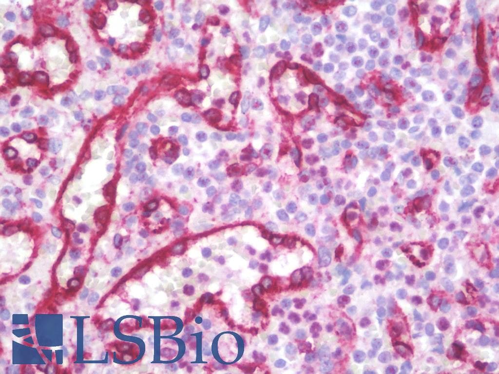 IHC-plus™ Polyclonal Rabbit anti-Human SDR / SDPR Antibody (IHC, IF, WB)