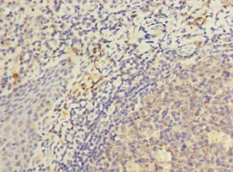 KIR3DL3 / CD158z Antibody