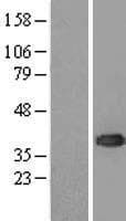 UBE2J1 Protein (Over-Expression Lysate Myc-DDK (Flag))