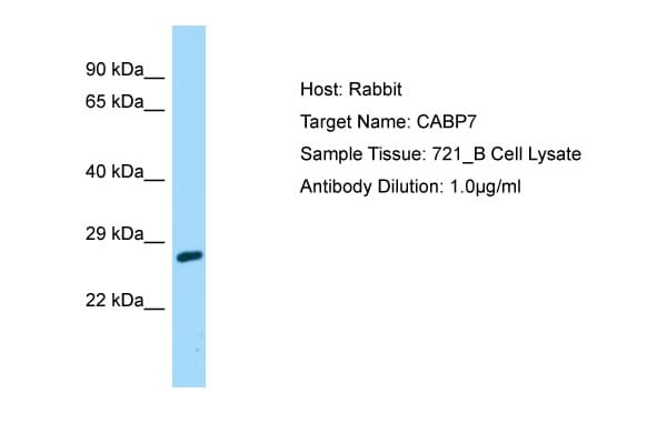 CABP7 Antibody (aa137-186)