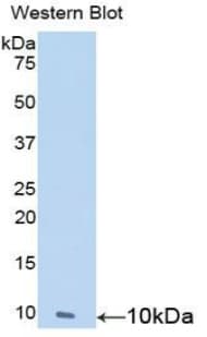 Nesfatin-1 Antibody (aa25-106)