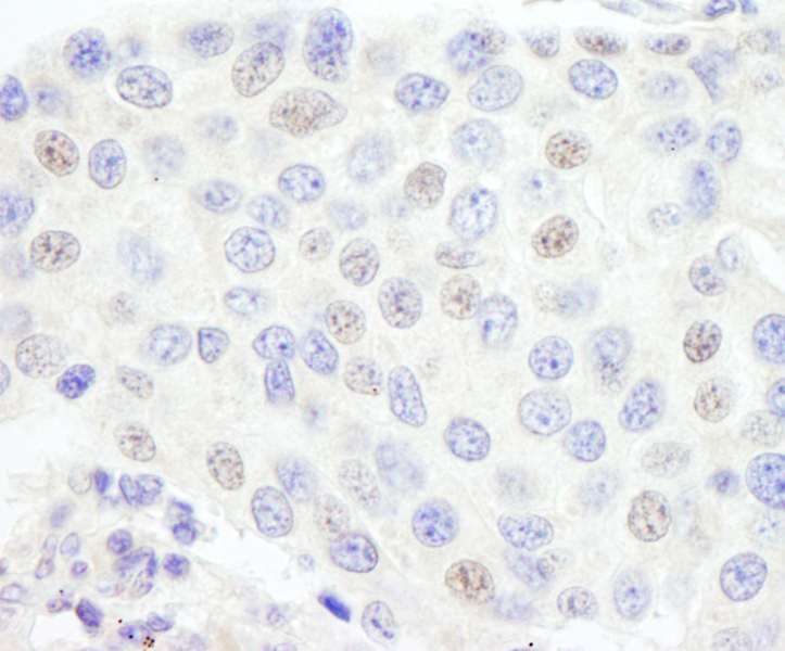 GTF3C1 Antibody (aa1475-1525)