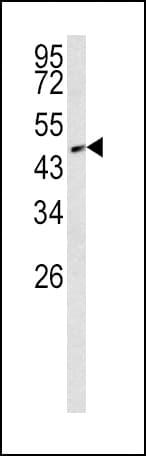 IHC-plus™ Polyclonal Rabbit anti-Human SMAD2 Antibody (Thr220, IHC, IF, WB)