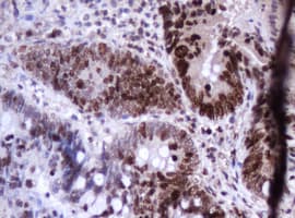 Monoclonal Mouse anti-Human MKI67 / Ki67 Antibody (clone OTI8H5, IHC)